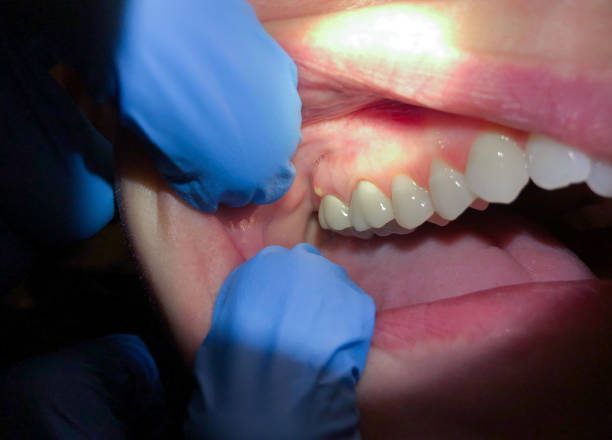 Best Orthodontic Emergency Dentist in Boiling Springs, NC