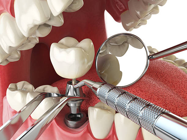 Best 24-Hour Emergency Dentist in Boiling Springs, NC
